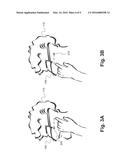 ULTRASOUND-BASED FACIAL AND MODAL TOUCH SENSING WITH HEAD WORN DEVICE diagram and image