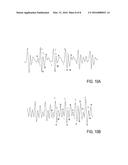 Vital Signs Fiber Optic Sensor Systems and Methods diagram and image