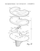 Prosthetic Knee Joint Measurement System Including Energy Harvesting And     Method Therefor diagram and image