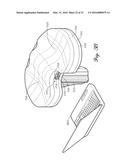 Prosthetic Knee Joint Measurement System Including Energy Harvesting And     Method Therefor diagram and image