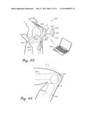 Prosthetic Knee Joint Measurement System Including Energy Harvesting And     Method Therefor diagram and image