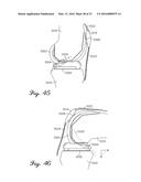 Prosthetic Knee Joint Measurement System Including Energy Harvesting And     Method Therefor diagram and image