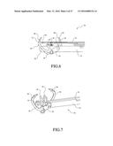 Laparoscopic Suture Device with Stripper Plate diagram and image