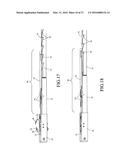 Laparoscopic Suture Device with Stripper Plate diagram and image