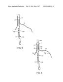 APPARATUS AND METHOD FOR MANIPULATING STOMACH TISSUE AND TREATING     GASTROESOPHAGEAL REFLUX DISEASE diagram and image