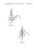 APPARATUS AND METHOD FOR MANIPULATING STOMACH TISSUE AND TREATING     GASTROESOPHAGEAL REFLUX DISEASE diagram and image