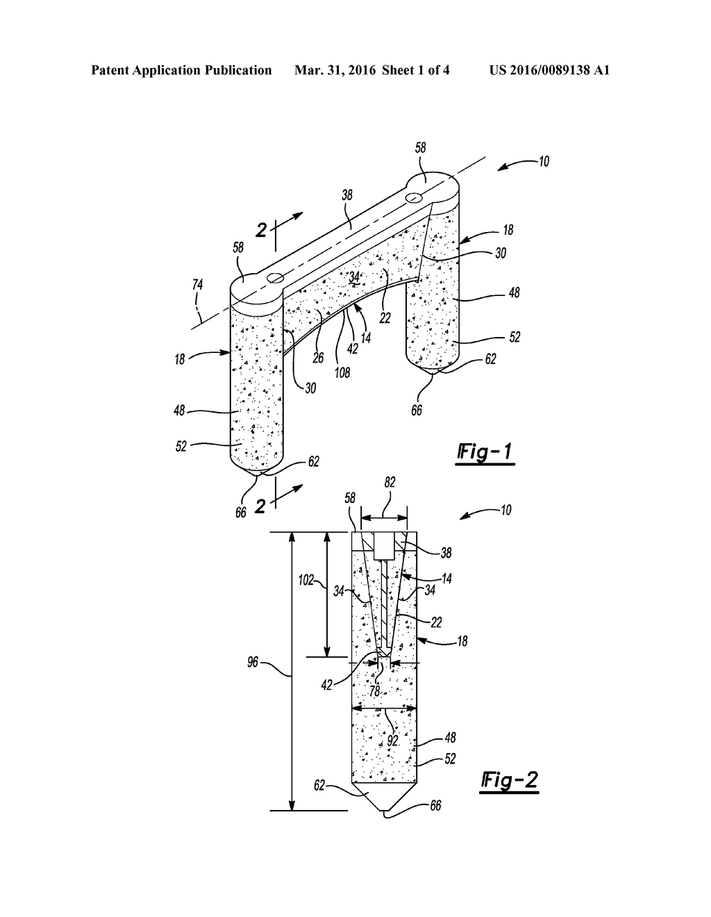 METHOD AND APPARATUS FOR BONE FIXATION - diagram, schematic, and image 02