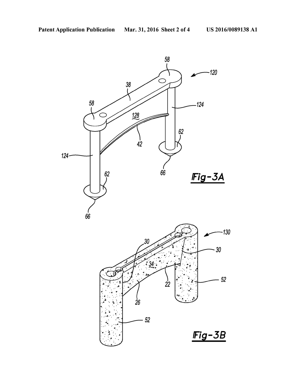 METHOD AND APPARATUS FOR BONE FIXATION - diagram, schematic, and image 03