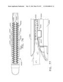 FASTENER CARTRIDGE FOR CREATING A FLEXIBLE STAPLE LINE diagram and image