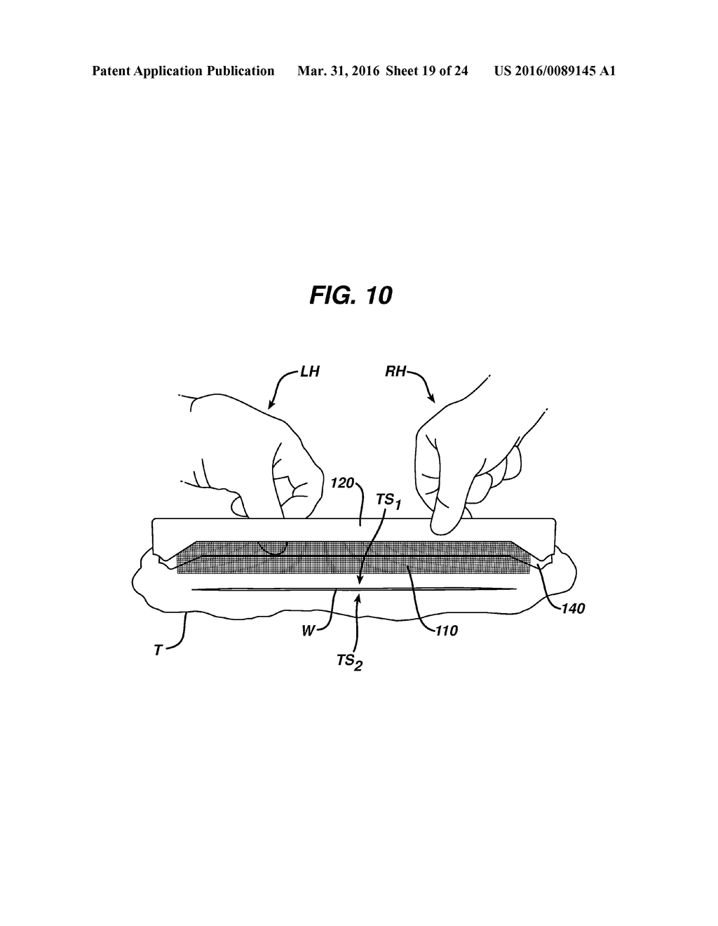 METHODS AND DEVICES FOR WOUND CLOSURE - diagram, schematic, and image 20