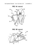 Gage for Limiting Distal Travel of Drill Pin diagram and image