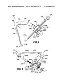 Gage for Limiting Distal Travel of Drill Pin diagram and image