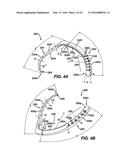 Gage for Limiting Distal Travel of Drill Pin diagram and image