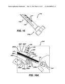 Gage for Limiting Distal Travel of Drill Pin diagram and image