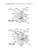 Gage for Limiting Distal Travel of Drill Pin diagram and image