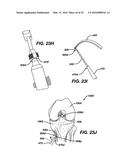 Gage for Limiting Distal Travel of Drill Pin diagram and image