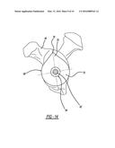 Adjustable Glenoid Pin Insertion Guide diagram and image