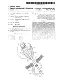 SURGICAL STABILIZER AND CLOSURE SYSTEM diagram and image