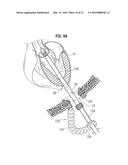 SURGICAL STABILIZER AND CLOSURE SYSTEM diagram and image