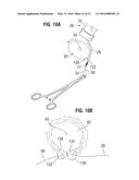 SURGICAL STABILIZER AND CLOSURE SYSTEM diagram and image