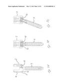 Orthopedic Implant Kit diagram and image