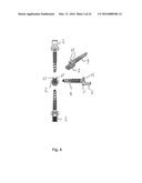 Orthopedic Implant Kit diagram and image