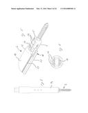 Orthopedic Implant Kit diagram and image