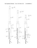 Orthopedic Implant Kit diagram and image