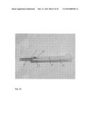 Orthopedic Implant Kit diagram and image