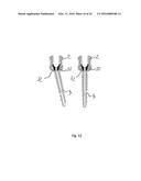 Orthopedic Implant Kit diagram and image