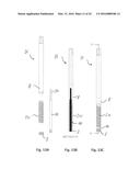 Orthopedic Implant Kit diagram and image