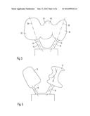 Process and Device for Manufacturing a Dental Restoration diagram and image