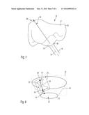 Process and Device for Manufacturing a Dental Restoration diagram and image