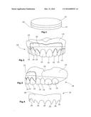 DENTAL PROSTHESES diagram and image