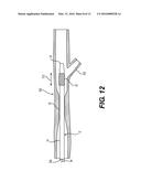 TEMPORARY EMBOLIC PROTECTION DEVICE AND METHODS THEREOF diagram and image