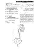 URETERAL STENTS WITH WAVEFORM INTERLAYERS AND INTERSTITCHING diagram and image