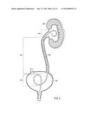 URETERAL STENTS WITH WAVEFORM INTERLAYERS AND INTERSTITCHING diagram and image