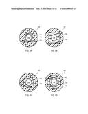 URETERAL STENTS WITH WAVEFORM INTERLAYERS AND INTERSTITCHING diagram and image