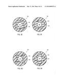 URETERAL STENTS WITH WAVEFORM INTERLAYERS AND INTERSTITCHING diagram and image