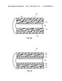 URETERAL STENTS WITH WAVEFORM INTERLAYERS AND INTERSTITCHING diagram and image