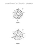 URETERAL STENTS WITH WAVEFORM INTERLAYERS AND INTERSTITCHING diagram and image