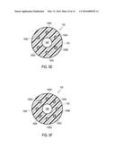 URETERAL STENTS WITH WAVEFORM INTERLAYERS AND INTERSTITCHING diagram and image