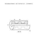 URETERAL STENTS WITH WAVEFORM INTERLAYERS AND INTERSTITCHING diagram and image