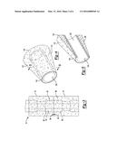 IMPLANTS FOR FIXATION OF THE DISTAL TIBIA diagram and image