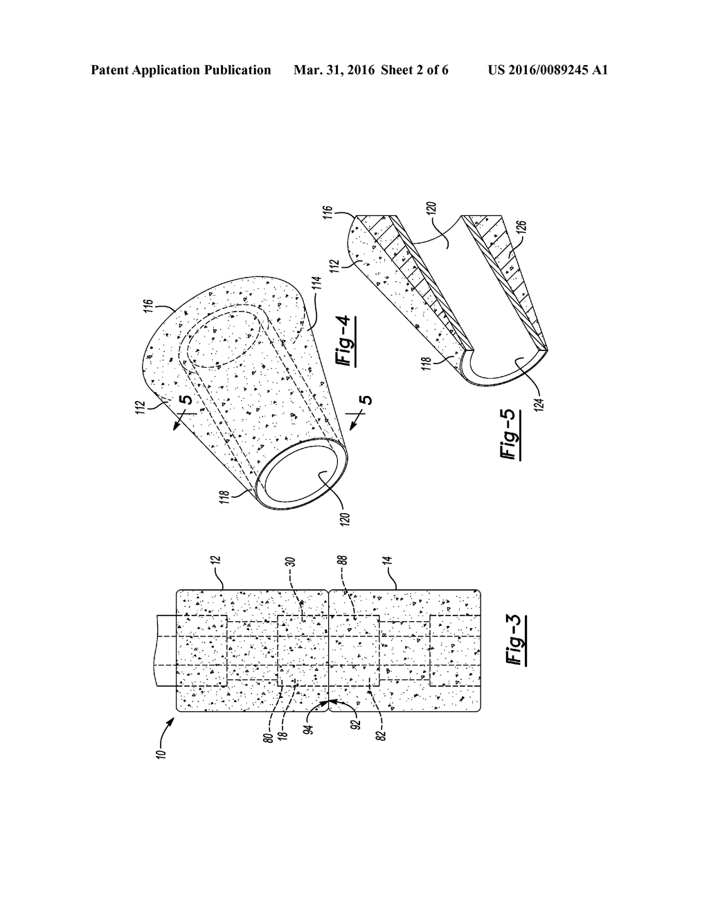 IMPLANTS FOR FIXATION OF THE DISTAL TIBIA - diagram, schematic, and image 03