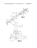 IMPLANTS FOR FIXATION OF THE DISTAL TIBIA diagram and image