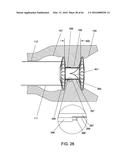 DELIVERY DEVICES AND METHODS FOR GASTROINTESTINAL IMPLANTS diagram and image