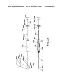 DELIVERY DEVICES AND METHODS FOR GASTROINTESTINAL IMPLANTS diagram and image