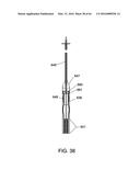 DELIVERY DEVICES AND METHODS FOR GASTROINTESTINAL IMPLANTS diagram and image