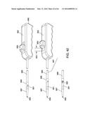 DELIVERY DEVICES AND METHODS FOR GASTROINTESTINAL IMPLANTS diagram and image